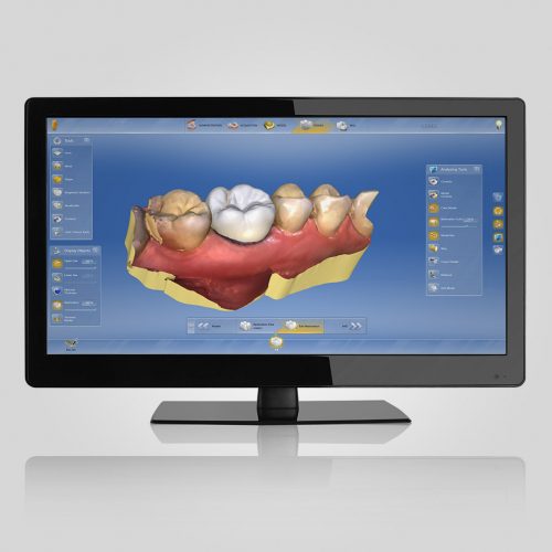 escáner intraoral 3D en Martorell