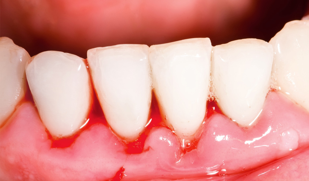 urgencias dentales en Martorell